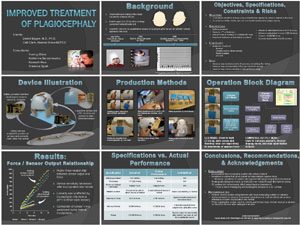 Sensor System for Improved Treatment of Plagiocephaly